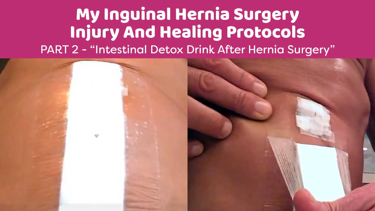 My Inguinal Hernia Surgery Injury And Healing Protocols Part 2