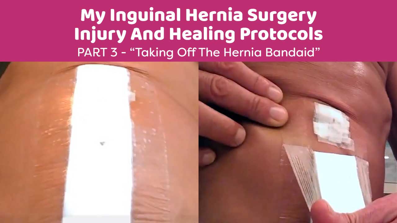 My Inguinal Hernia Surgery Injury And Healing Protocols Part 3