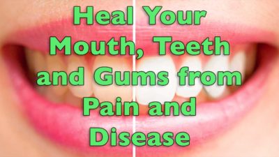 Heal Your Mouth, Teeth and Gums from Pain and Disease