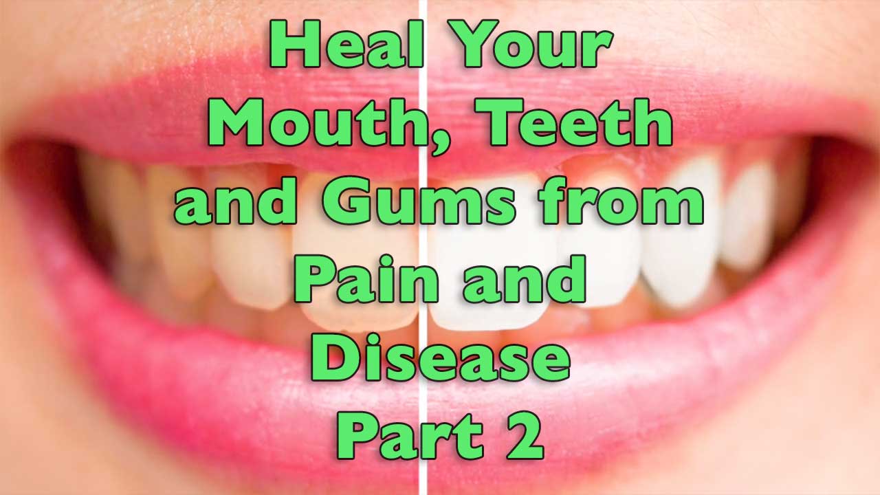 Heal Your Mouth, Teeth and Gums from Pain and Disease Part 2