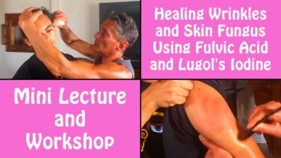 Healing Wrinkles and Skin Fungus Using Fulvic Acid and Lugol's Iodine