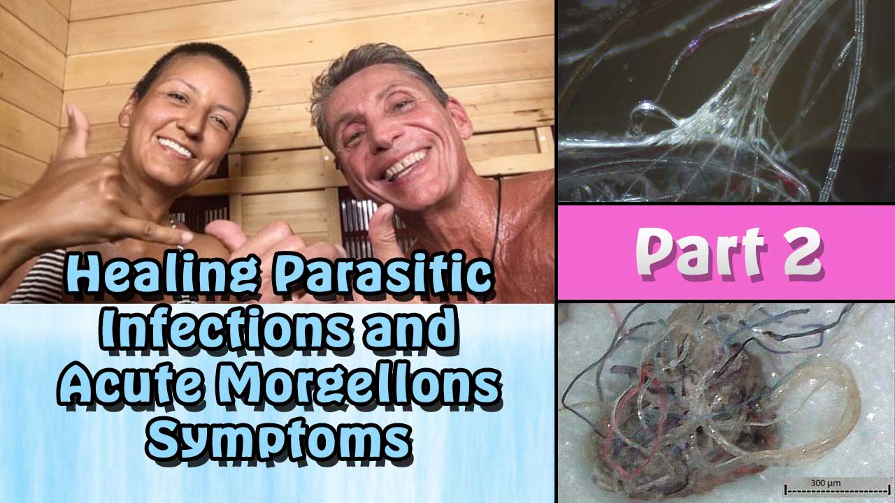 Healing Parasitic Infections and Acute Morgellons Symptoms Workshop