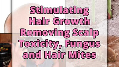 Stimulating Hair Growth Removing Scalp Toxicity, Fungus and Hair Mites