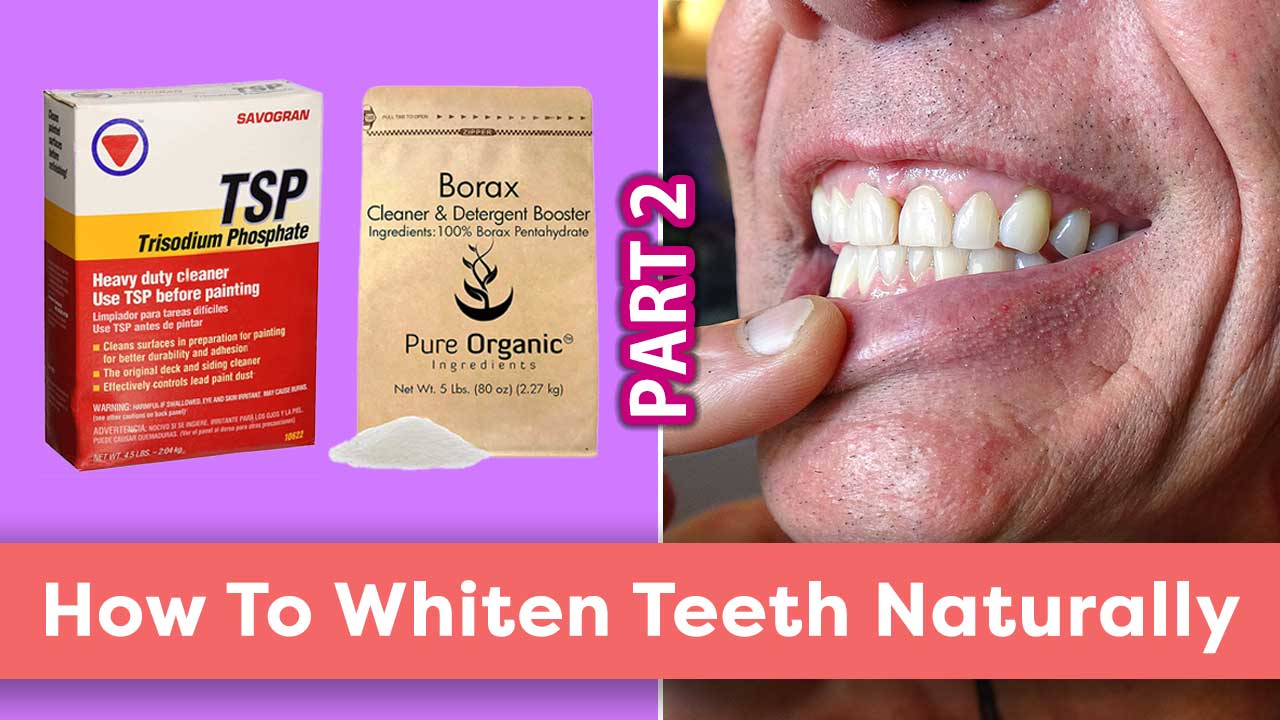 How To Whiten Teeth Naturally Part 2