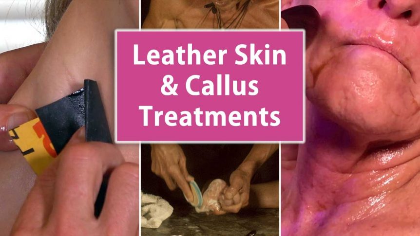 Leather Skin and Callus Treatments