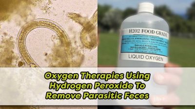 Oxygen Therapies Using Hydrogen Peroxide To Remove Parasitic Feces