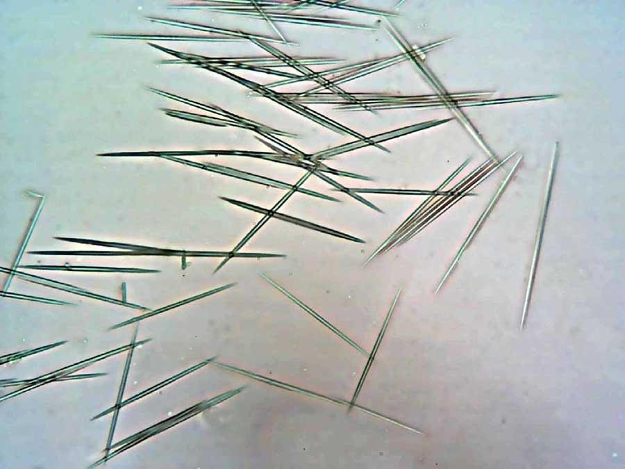 Microscopic Oxalate Raphide Crystals - Shaped Like Tiny Needles
